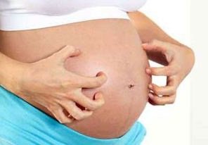 gatal-selama-hamil-berikut-tips-mengatasinya
